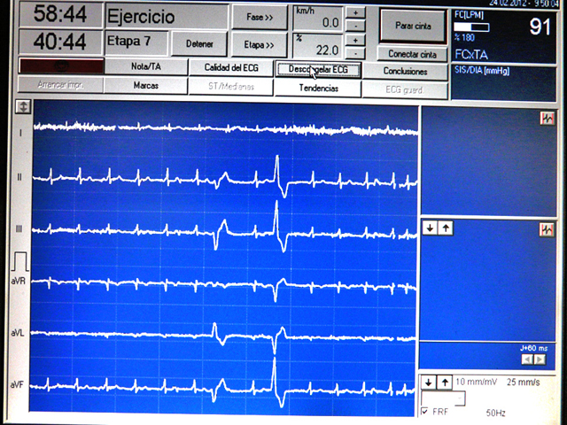 reconocimiento médico deportivo